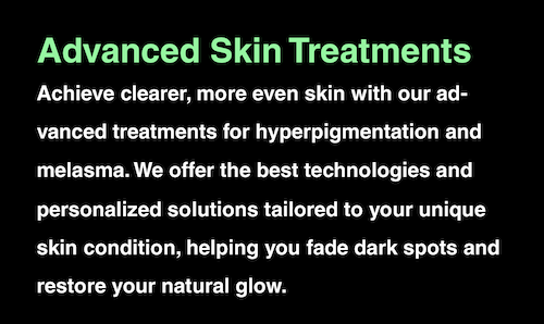 Hyperpigmentation Melasma Treatments Mississauga Oakville Best Skincare Solutions